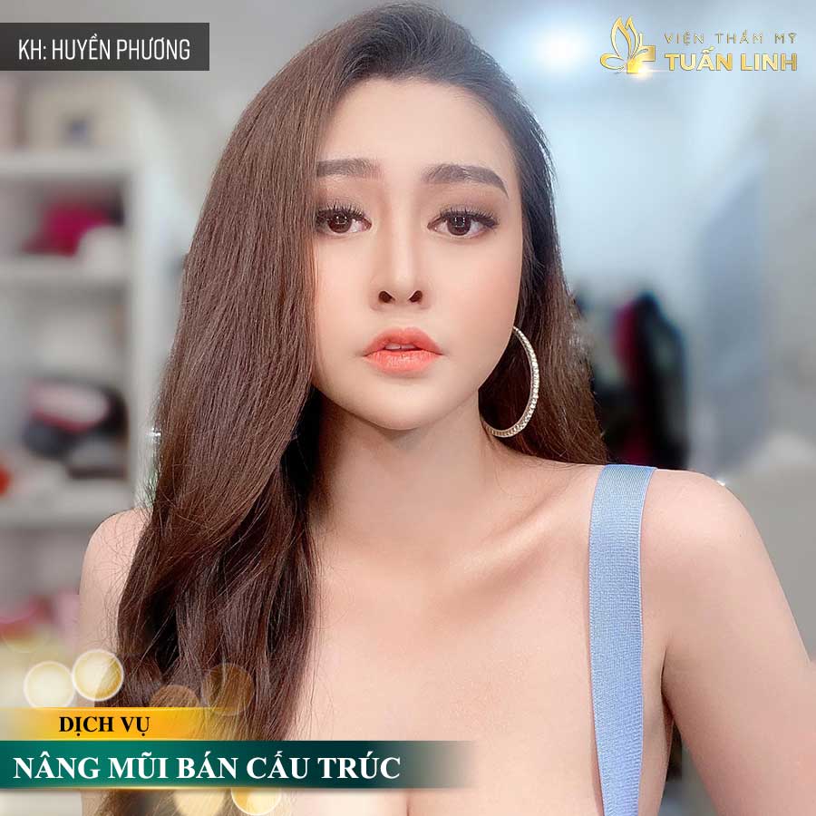 Hình ảnh khách hàng tại Tuấn Linh