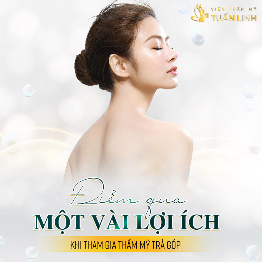 Điểm qua một vài lợi ích khi tham gia thẩm mỹ trả góp