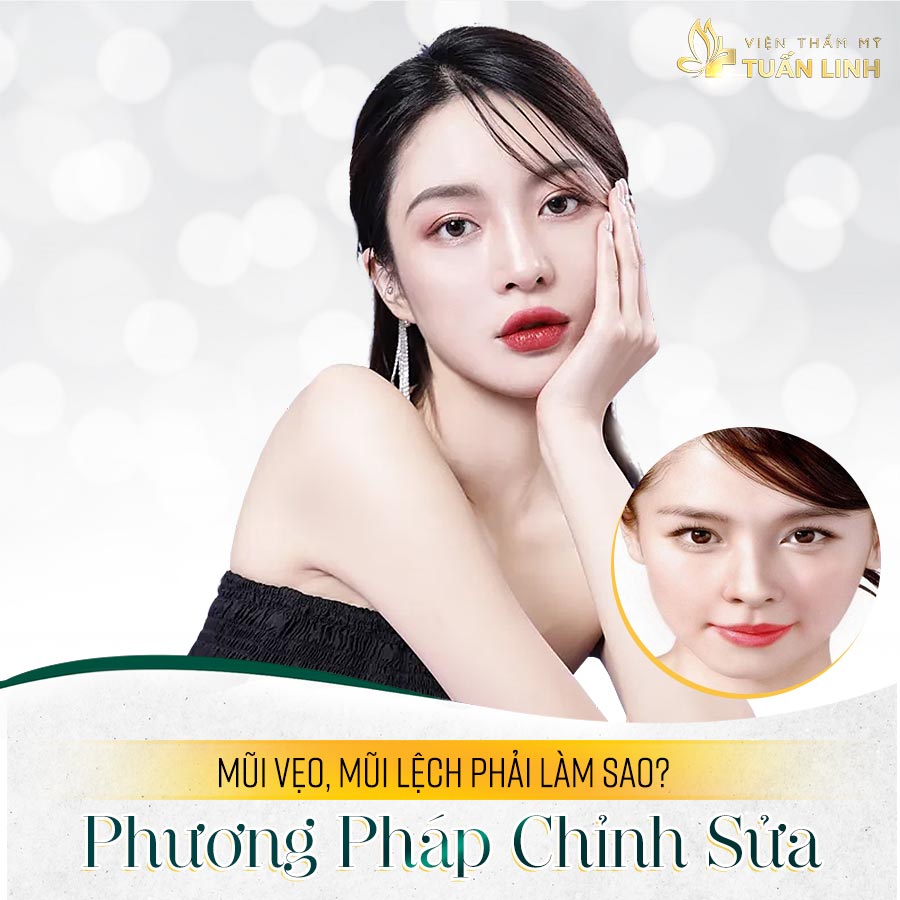 Mũi vẹo, mũi lệch phải làm sao? Phương pháp chỉnh sửa