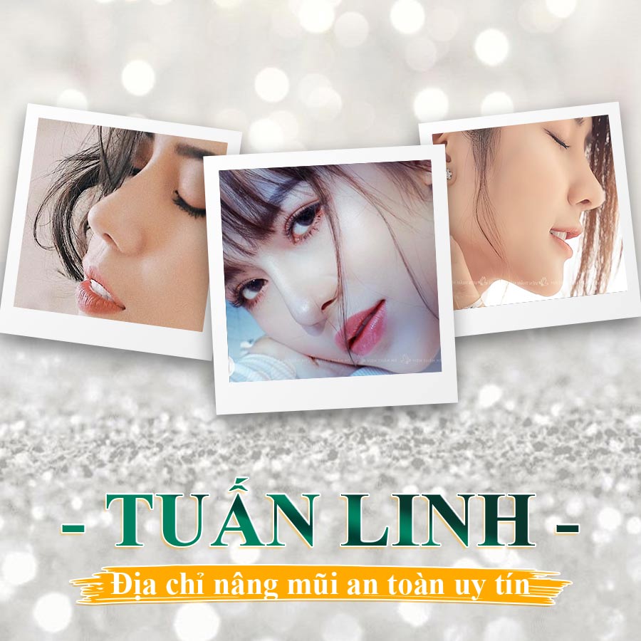Nâng mũi an toàn tại Tuấn Linh | “Biết tuốt” về sụn Nanoform | Chia sẻ từ chuyên gia