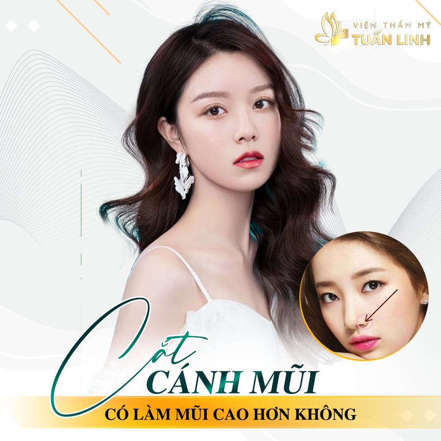 Cắt cánh mũi có làm mũi cao hơn không | Cắt cánh mũi và những thông tin liên quan