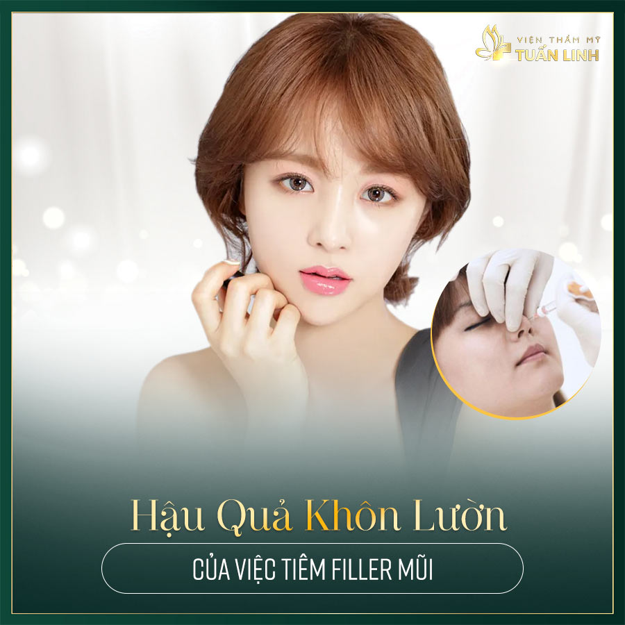 Hậu quả khôn lườn của việc tiêm filler mũi | Từ A đến Z những thông tin về tiêm filler mũi mà bạn cần biết