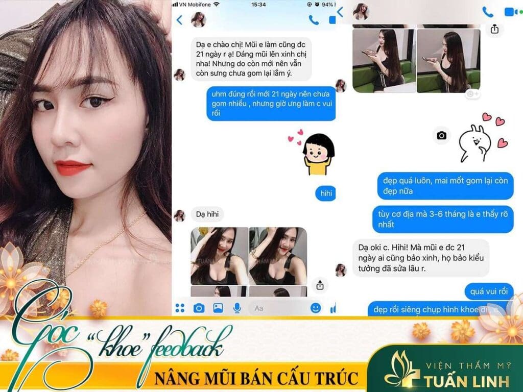 feedback của khách hàng nâng mũi bán cấu trúc