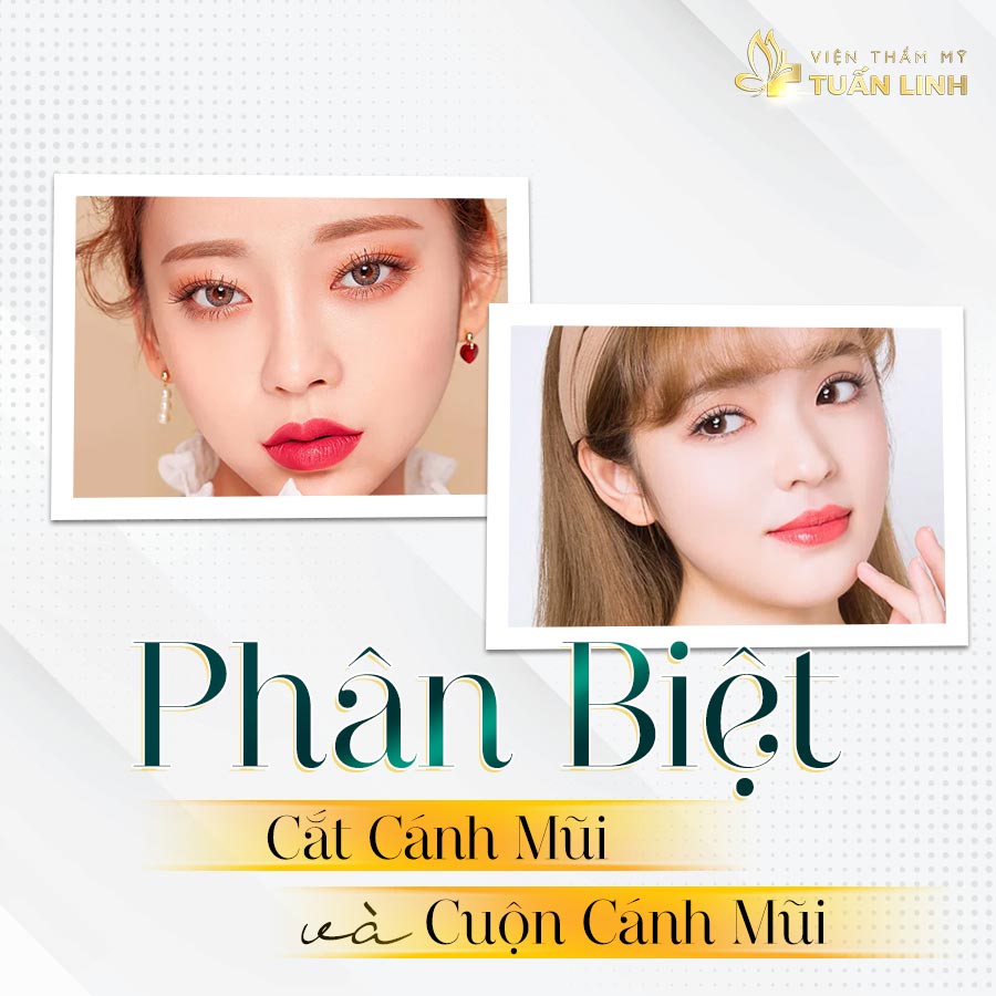 So sánh cắt cánh mũi và cuộn cánh mũi | Cắt cánh mũi và những thông tin liên quan
