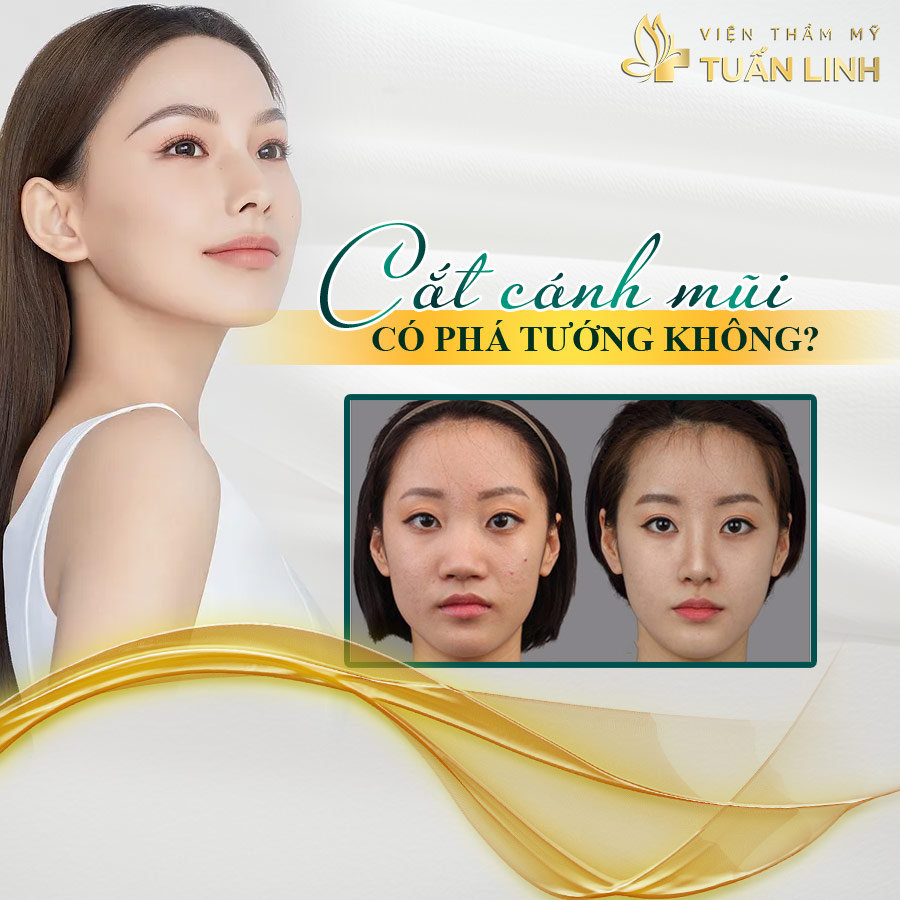 Cắt cánh mũi có phá tướng không? Có mất lộc không??