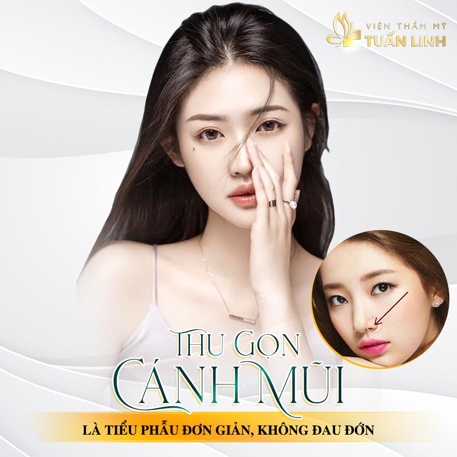 Thu gọn cánh mũi là tiểu phẫu đơn giản, không đau đớn | Thu gọn cánh mũi có đau không | Review từ hội chị em