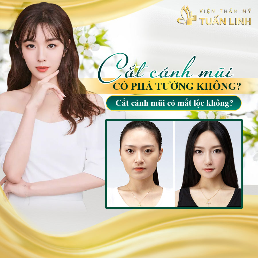 Liệu có gây phá tướng mất lộc? | Cắt cánh mũi có phá tướng không? Có mất lộc không??