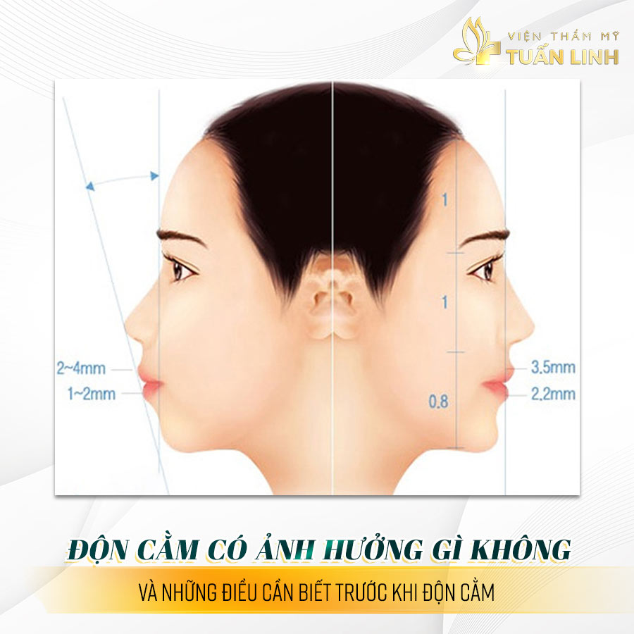 Độn cằm có ảnh hưởng gì không và những điều cần biết trước khi độn cằm?