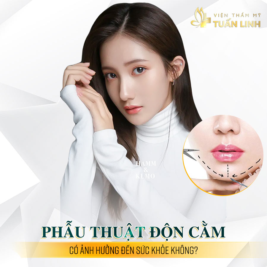 Phẫu thuật cằm có ảnh hưởng gì không | Độn cằm có ảnh hưởng gì không và những điều cần biết trước khi độn cằm?