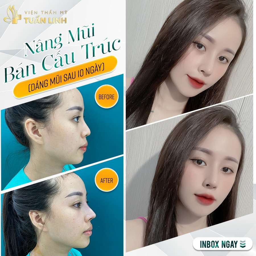ban cau truc 1