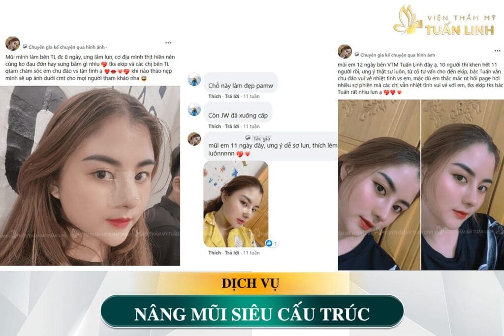 feedback nang mui sieu cau truc 2