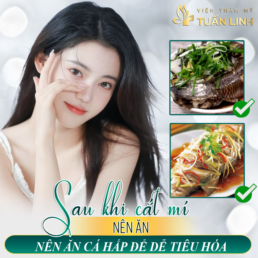 Sau khi cắt mí nên ăn cá hấp để dễ tiêu hóa