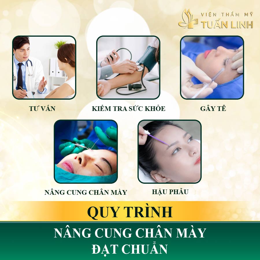 Quy trình nâng cung chân mày chuẩn y khoa | Bạn hỏi - Bác sĩ trả lời: Nâng cung chân mày 1 bên có được không?