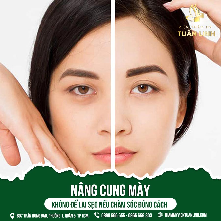 Nâng cung mày không để lại sẹo nếu chăm sóc đúng cách