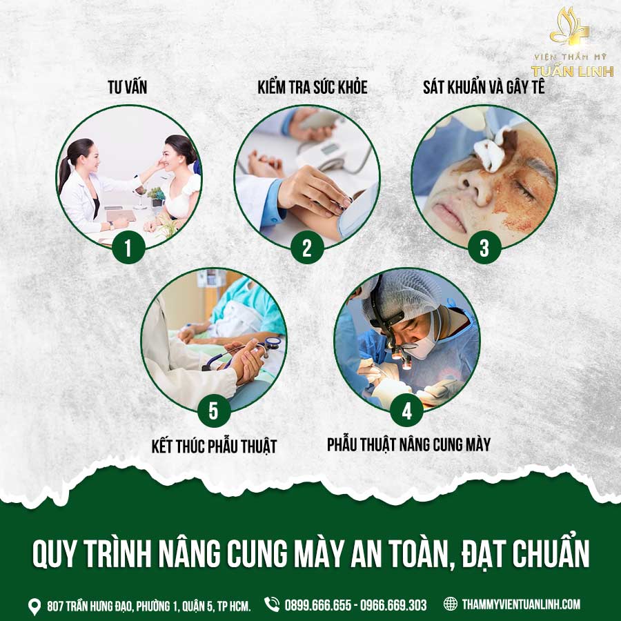 Quy trình nâng cung mày an toàn, đạt chuẩn