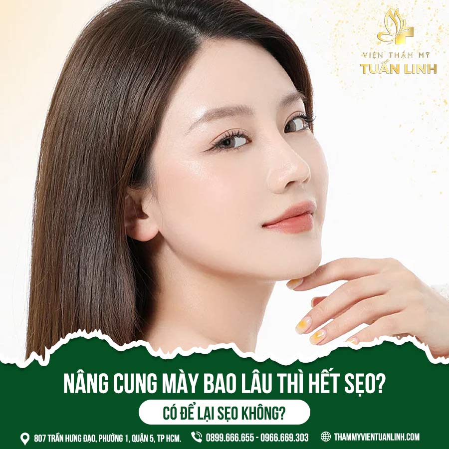Nâng cung mày bao lâu thì hết sẹo? Có để lại sẹo không?