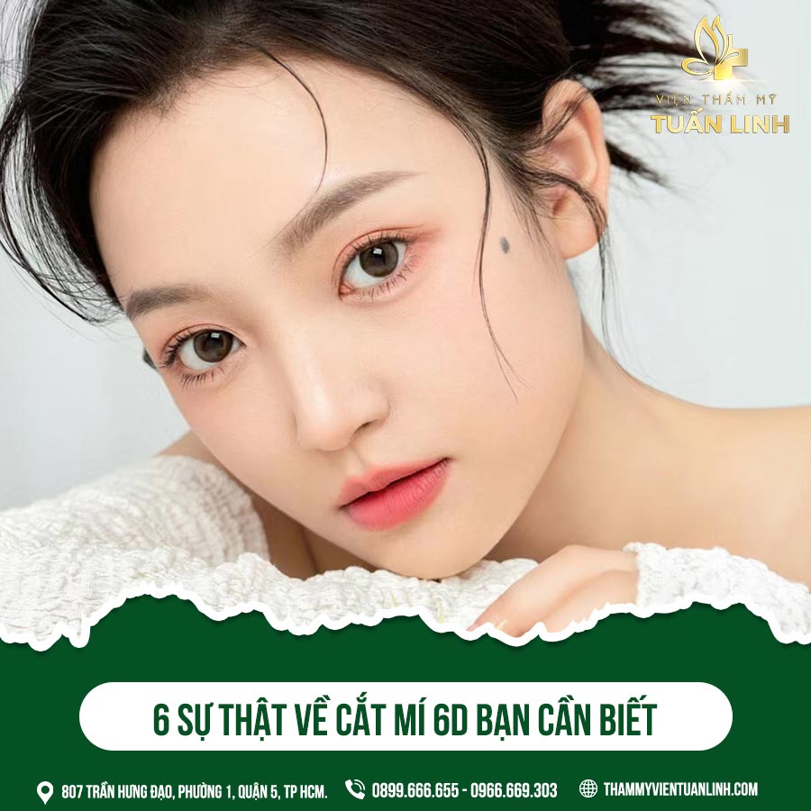 6 sự thật về cắt mí 6d bạn cần biết