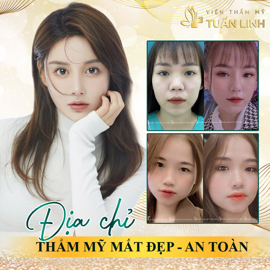 Địa chỉ cắt mí đẹp, an toàn | Cắt mí bị già: Nỗi lo của nhiều chị em