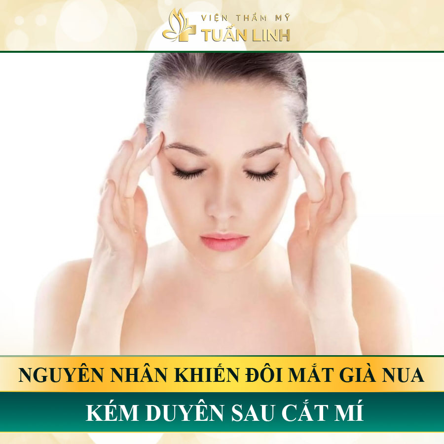 Nguyên nhân khiến đôi mắt già nua, kém duyên sau cắt mí | Cắt mí bị già: Nỗi lo của nhiều chị em