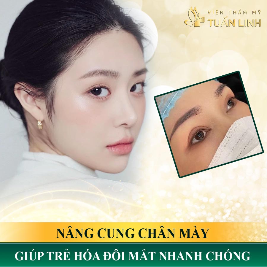 Nâng cung chân mày là phương pháp giúp trẻ hóa đôi mắt nhanh chóng | Nâng cung chân mày có đau không? 3 cách giảm đau đơn giản, hiệu quả