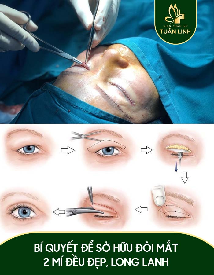 Bí quyết để sở hữu đôi mắt 2 mí đều đẹp, long lanh