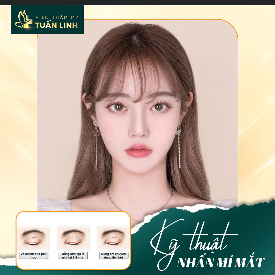 Kỹ thuật nhấn mí mắt