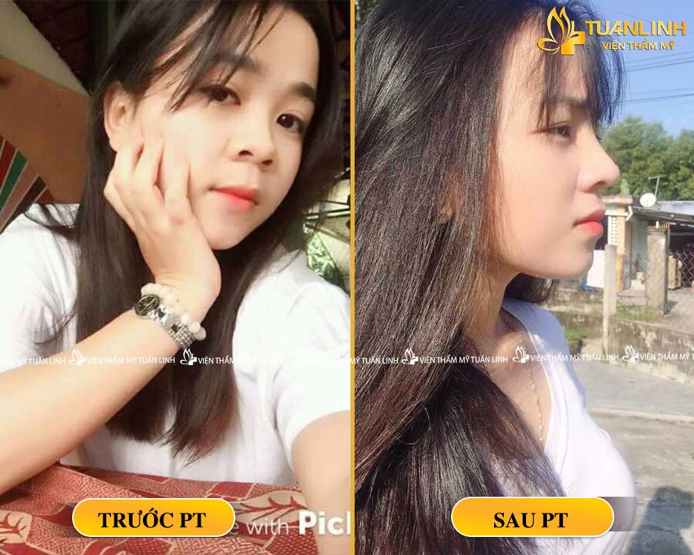 4 1