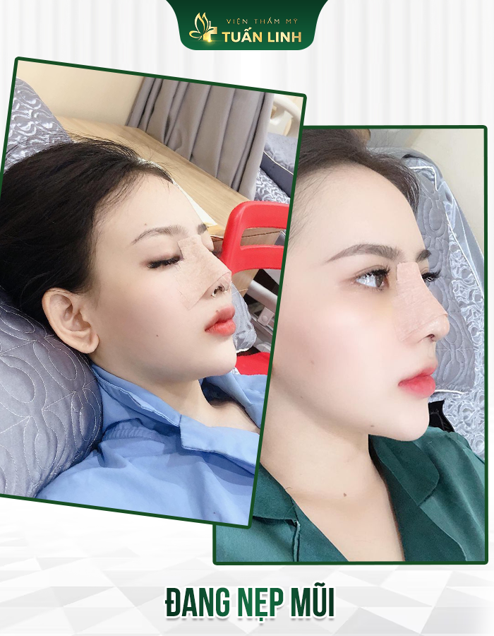 Chăm sóc hậu phẫu chu đáo, tận tâm cho mọi khách hàng sau phẫu thuật