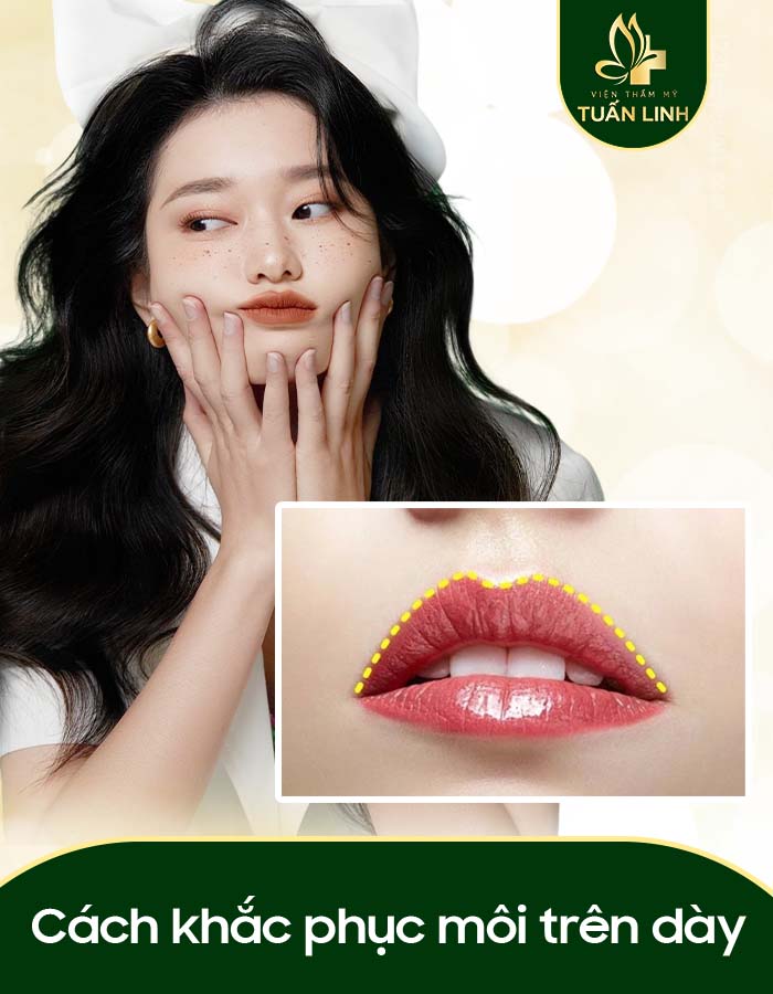 Cách khắc phục môi trên dày