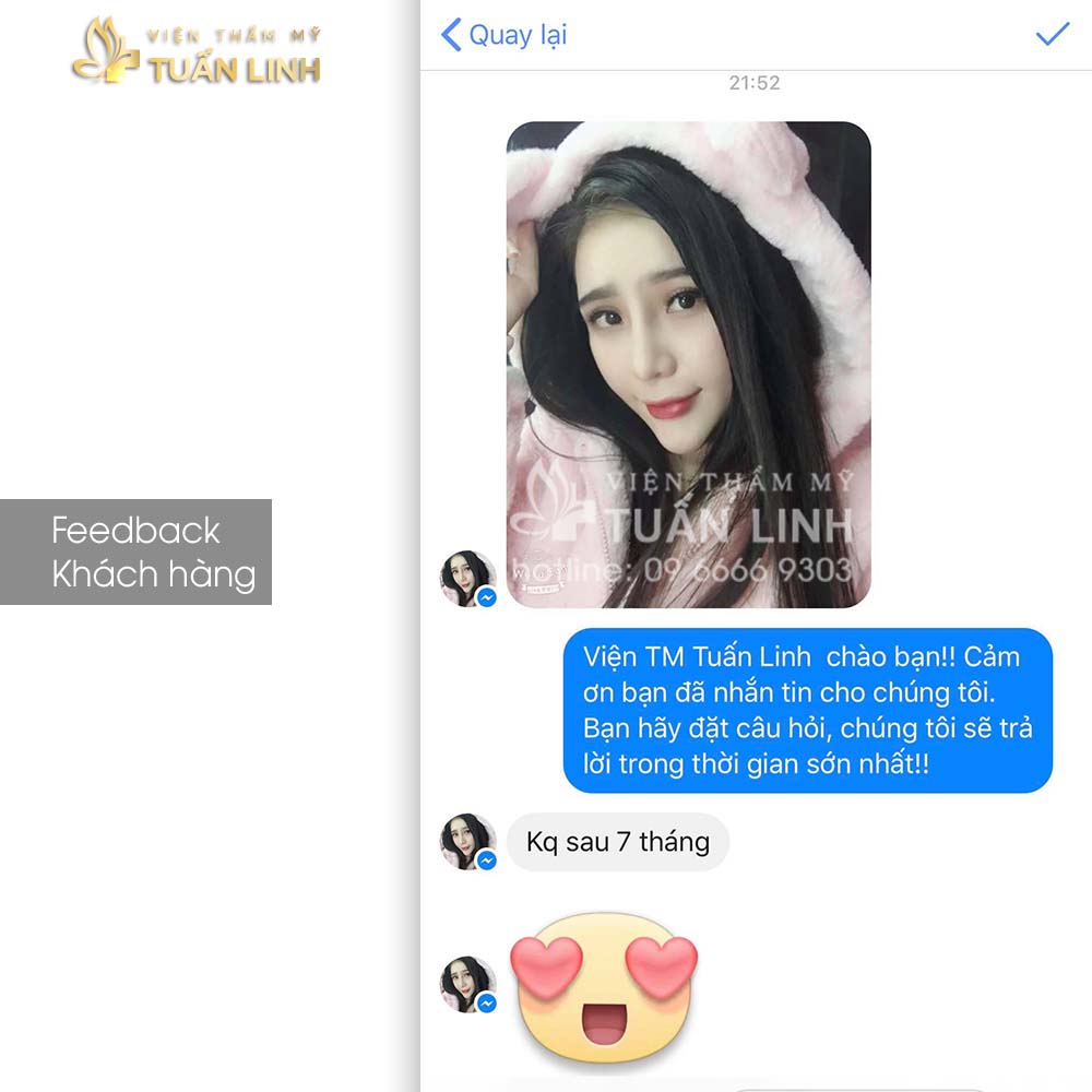 feedback nang mui moi nhat22 4