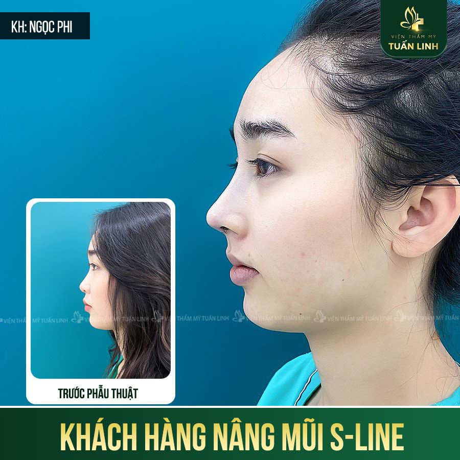 khach hang s line 2