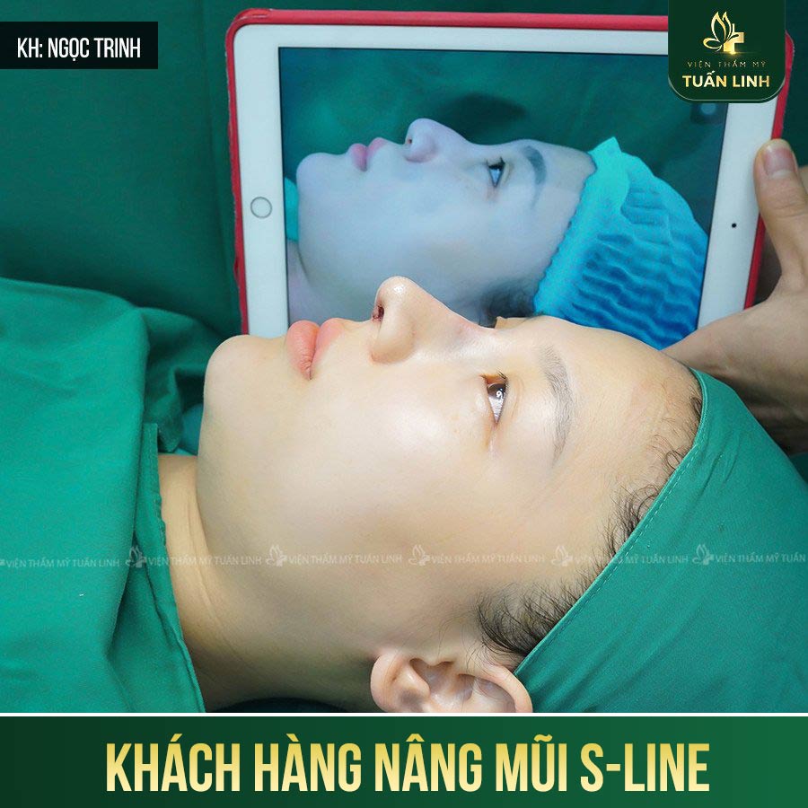 khach hang s line 4