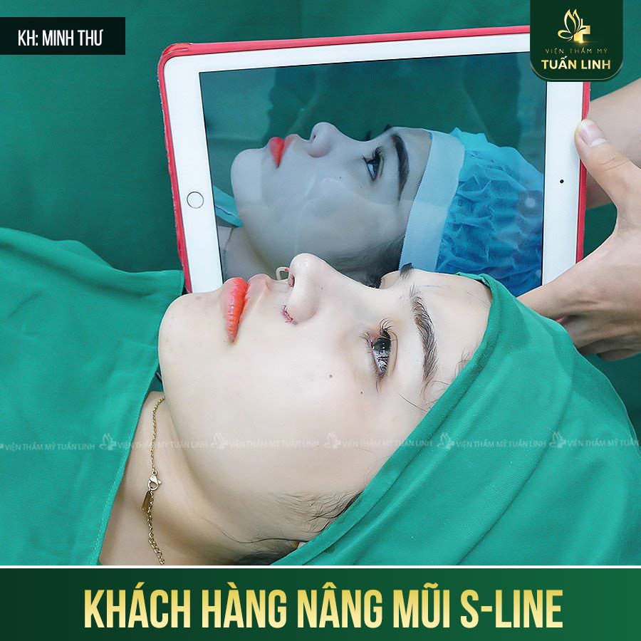 khach hang s line 5