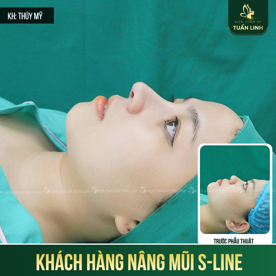 khach hang s line 6