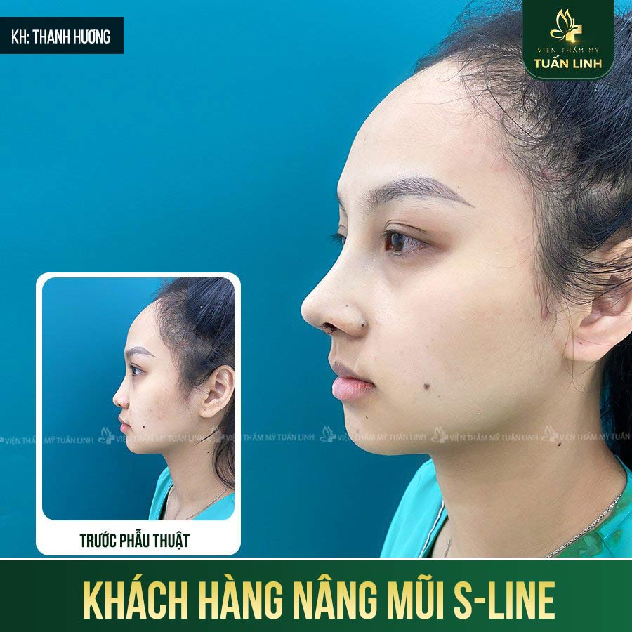 khach hang s line 7