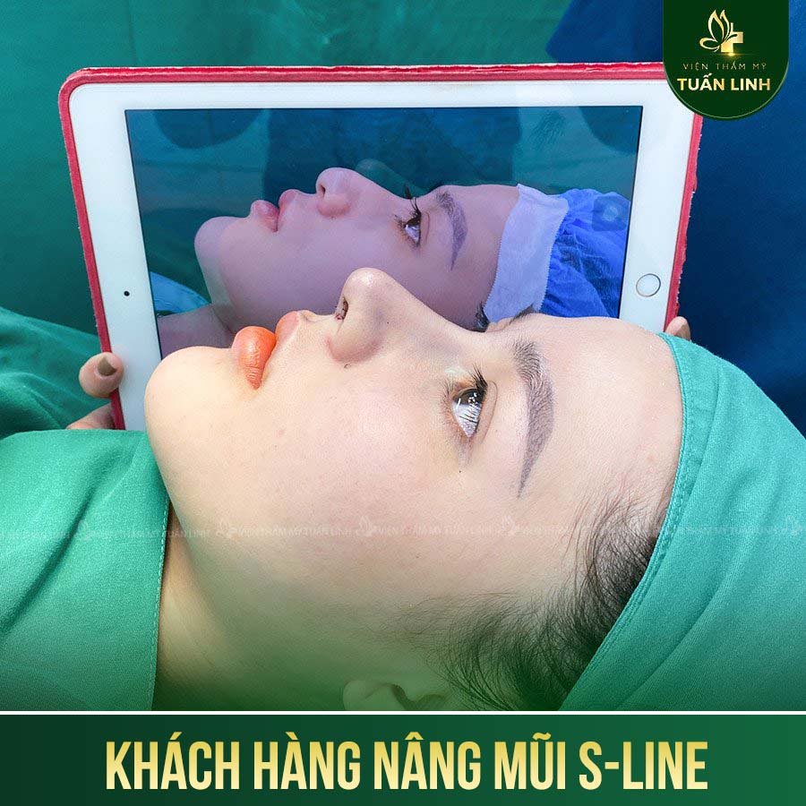 khach hang s line