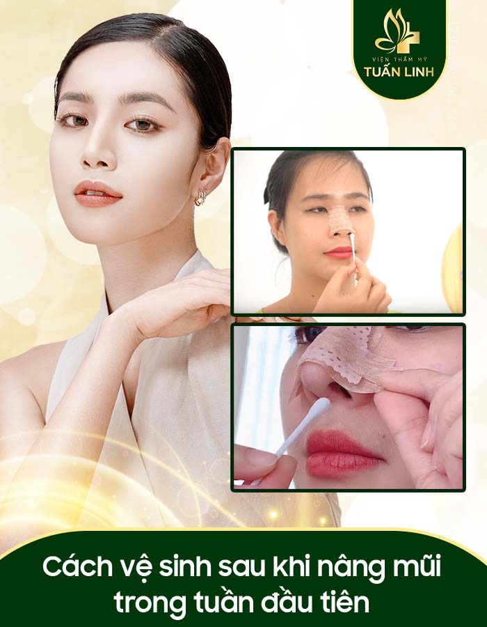 Cách vệ sinh sau khi nâng mũi trong tuần đầu tiên