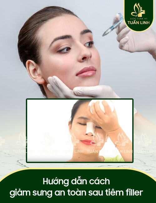 Hướng dẫn cách giảm sưng an toàn sau tiêm filler