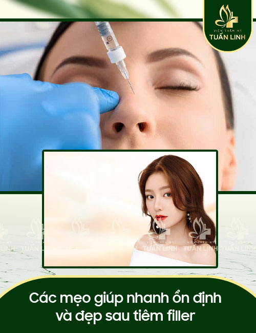 Các mẹo giúp nhanh ổn định và đẹp sau tiêm filler