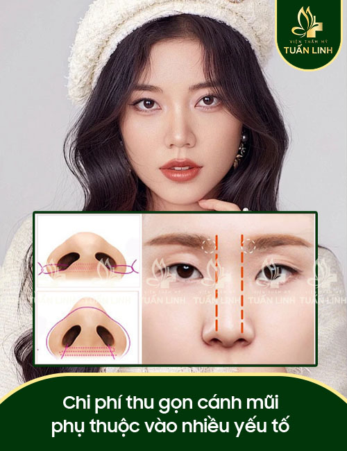 Chi phí thu gọn cánh mũi phụ thuộc vào nhiều yếu tố