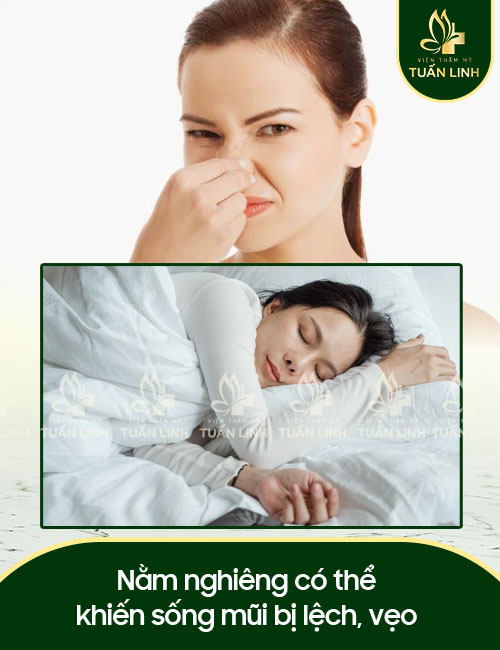Nằm nghiêng có thể khiến sống mũi bị lệch, vẹo