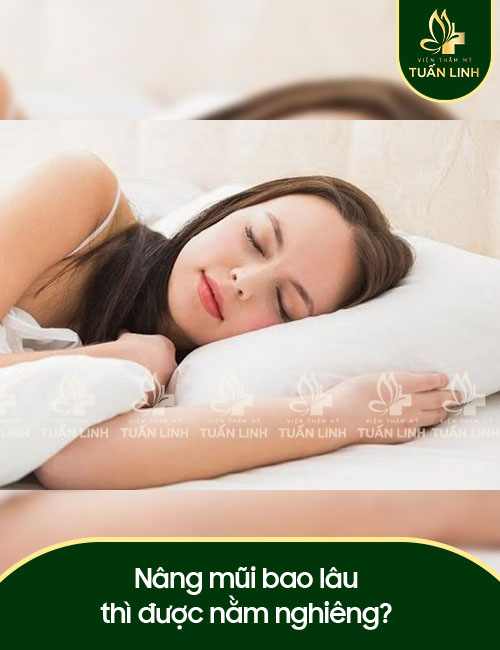 Nâng mũi bao lâu thì được nằm nghiêng?