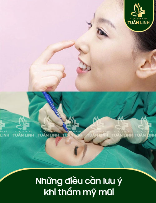Những điều cần lưu ý khi thẩm mỹ mũi
