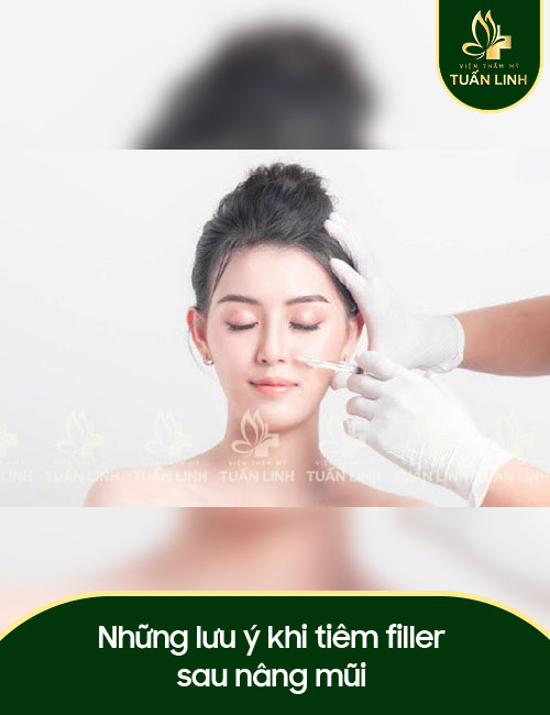 Những lưu ý khi tiêm filler sau nâng mũi