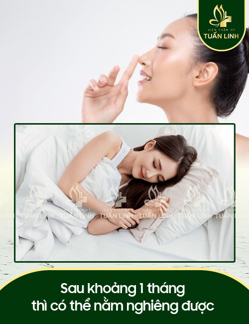 Sau khoảng 1 tháng thì có thể nằm nghiêng được