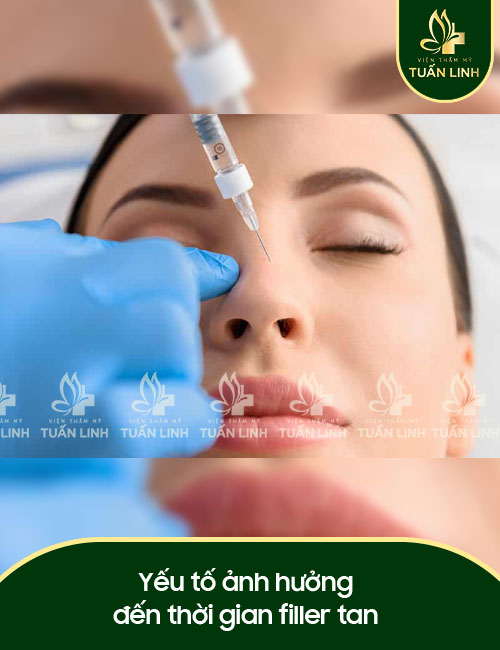Yếu tố ảnh hưởng đến thời gian filler tan